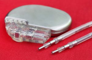 起搏器医疗设备的激光焊接
