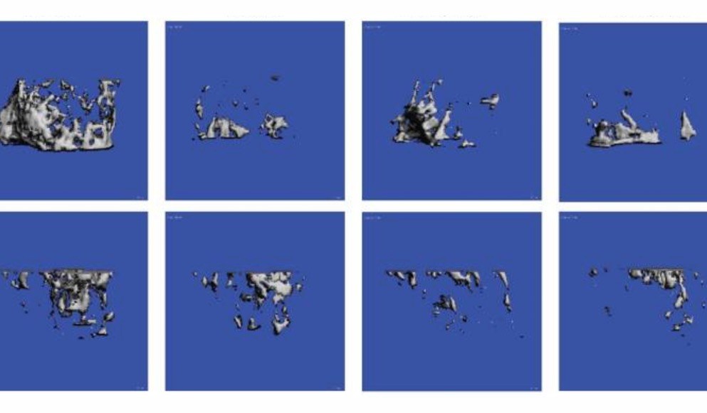 Case Studies in the Assessment of Skeletal Muscle Function in Rodent Models of Cancer Cachexia