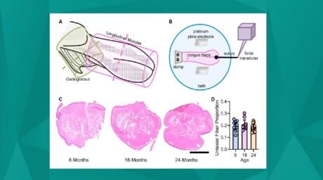 Down to the Muscle: Sarcopenia Modelling and Interventions