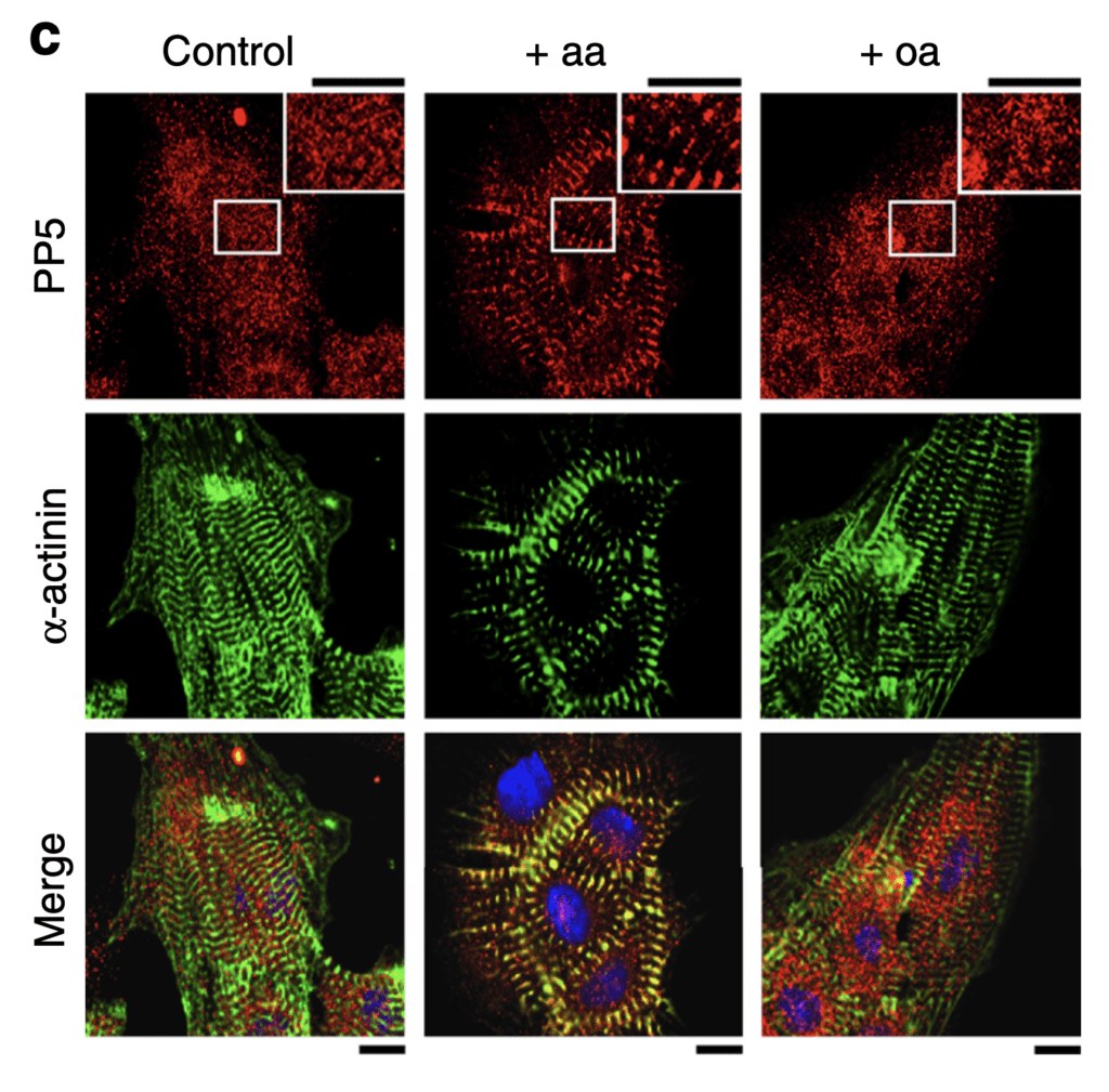 In-Vitro Assessment of Calcium Activated Force Production in Skinned Cardiac Myocytes