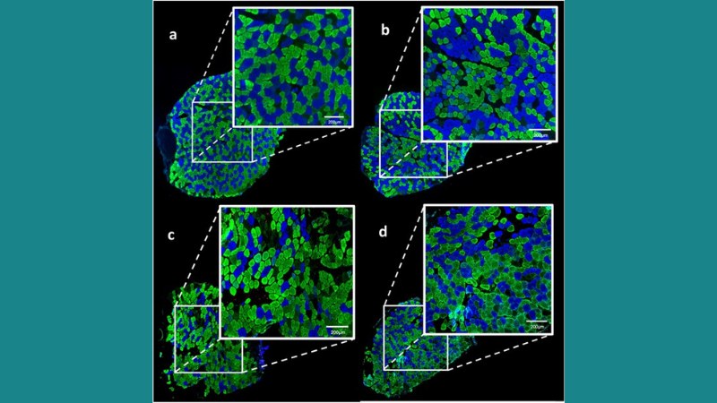 Modelling Exercise-Induced Muscular Changes Using Dynamic Contractions
