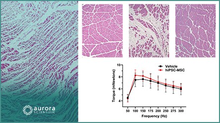 Pumped Up: Advances in Cardiovascular Research