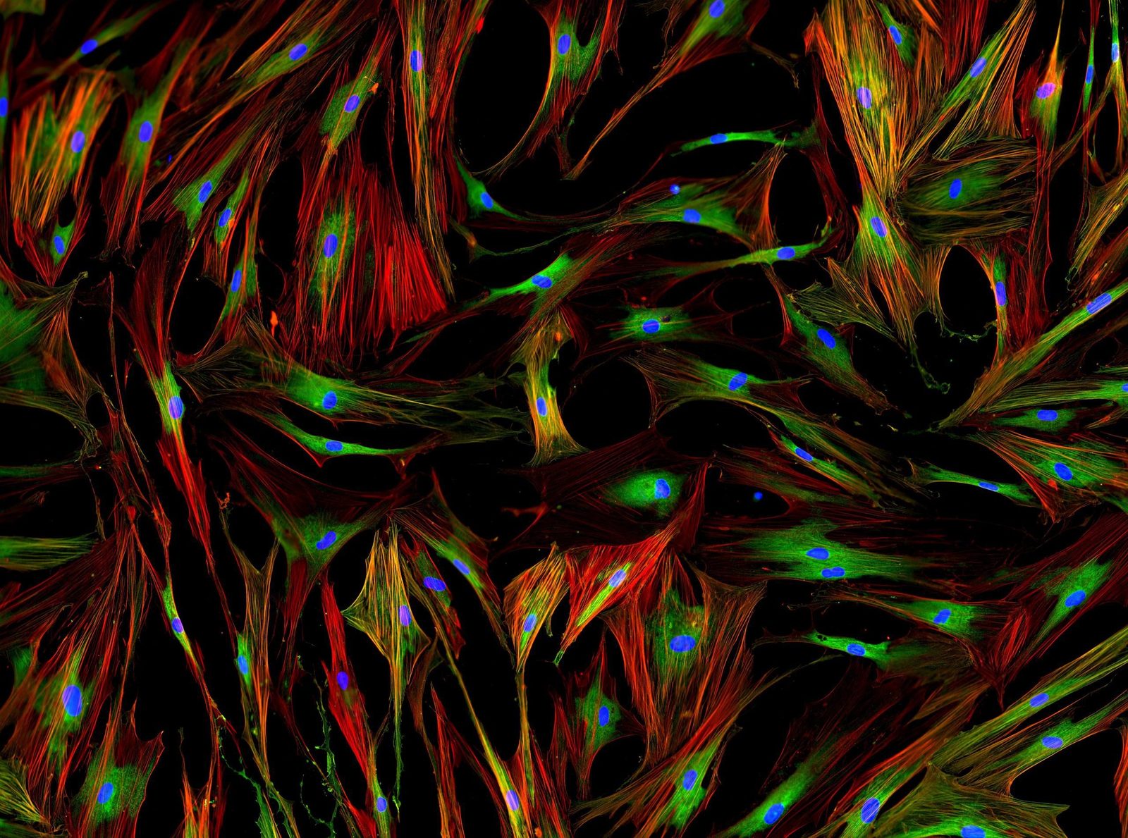 Live-Cell Imaging with Advanced Microscopes