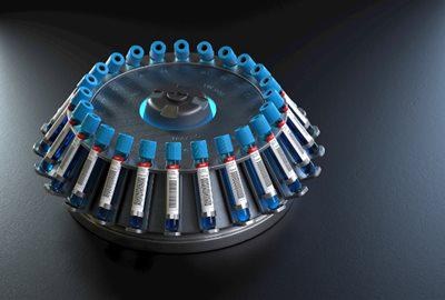 Thin Section Bearings Boost Medical Device Performance
