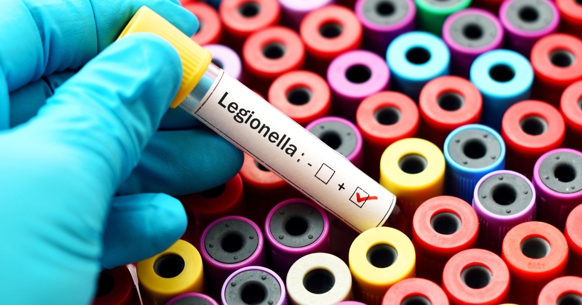Legionella Testing Requirements UK