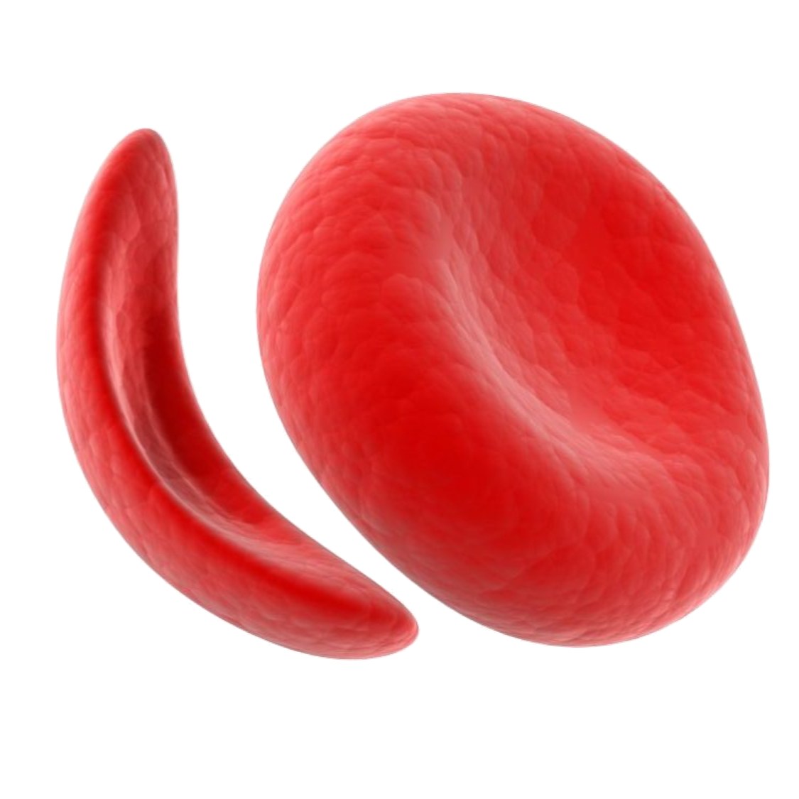Sickle Cell Genetics Lab: Diagnosing Baby Marie™