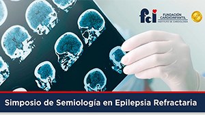 Semiology Conference on Refractory Epilepsy – Neurovirtual